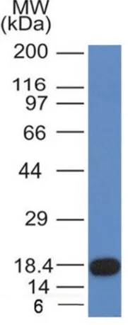 Western blot - Anti-c-Kit antibody [KIT/982] - BSA and Azide free (AB212519)