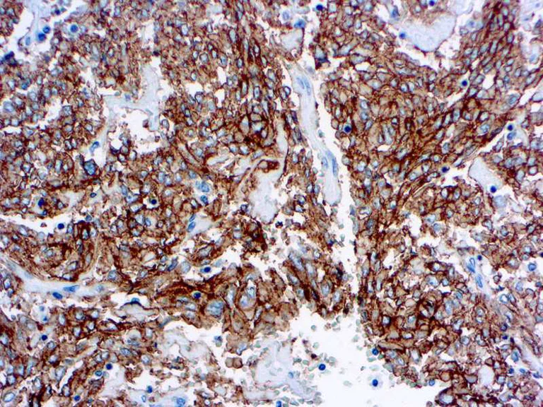 Immunohistochemistry (Formalin/PFA-fixed paraffin-embedded sections) - Anti-c-Kit antibody, prediluted (AB16931)