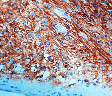 Immunohistochemistry (Formalin/PFA-fixed paraffin-embedded sections) - Anti-c-Kit antibody, prediluted (AB16931)