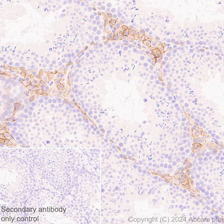 Immunohistochemistry (Formalin/PFA-fixed paraffin-embedded sections) - Anti-c-Kit antibody [RM1190] (AB317843)