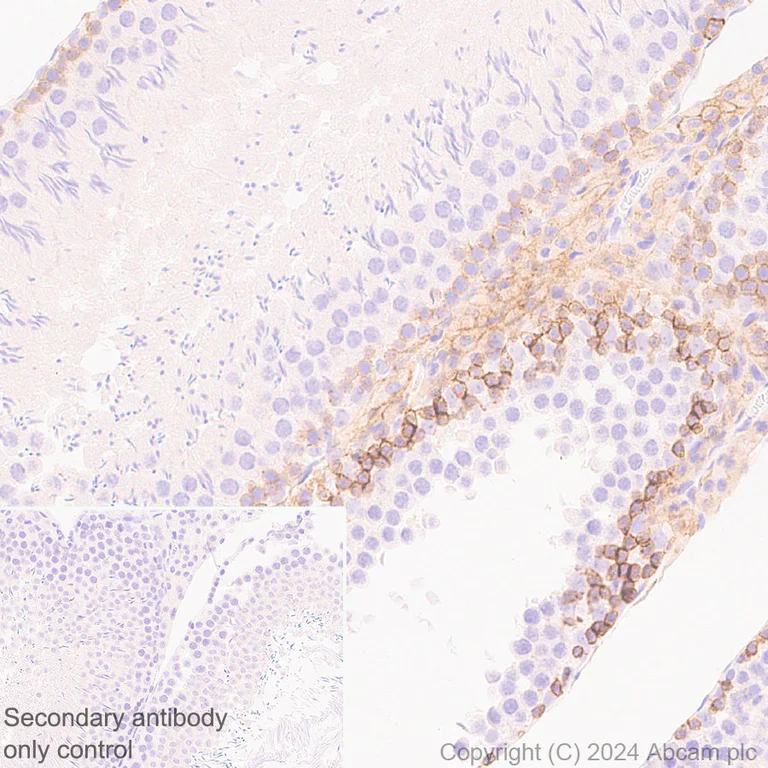 Immunohistochemistry (Formalin/PFA-fixed paraffin-embedded sections) - Anti-c-Kit antibody [RM1190] (AB317843)