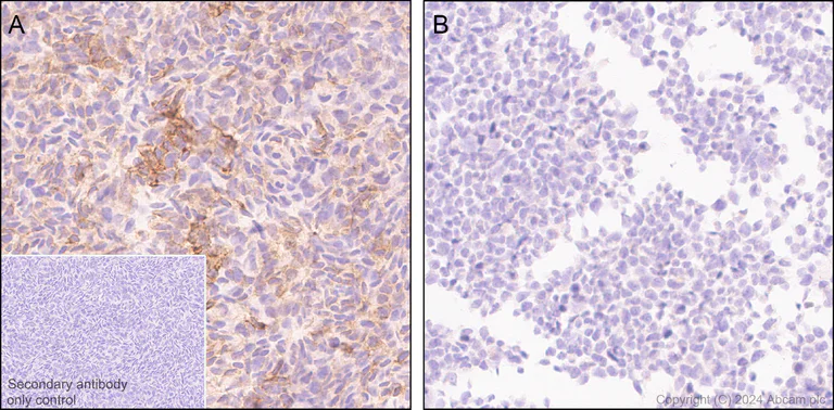 Immunohistochemistry (Formalin/PFA-fixed paraffin-embedded sections) - Anti-c-Kit antibody [RM1190] (AB317843)