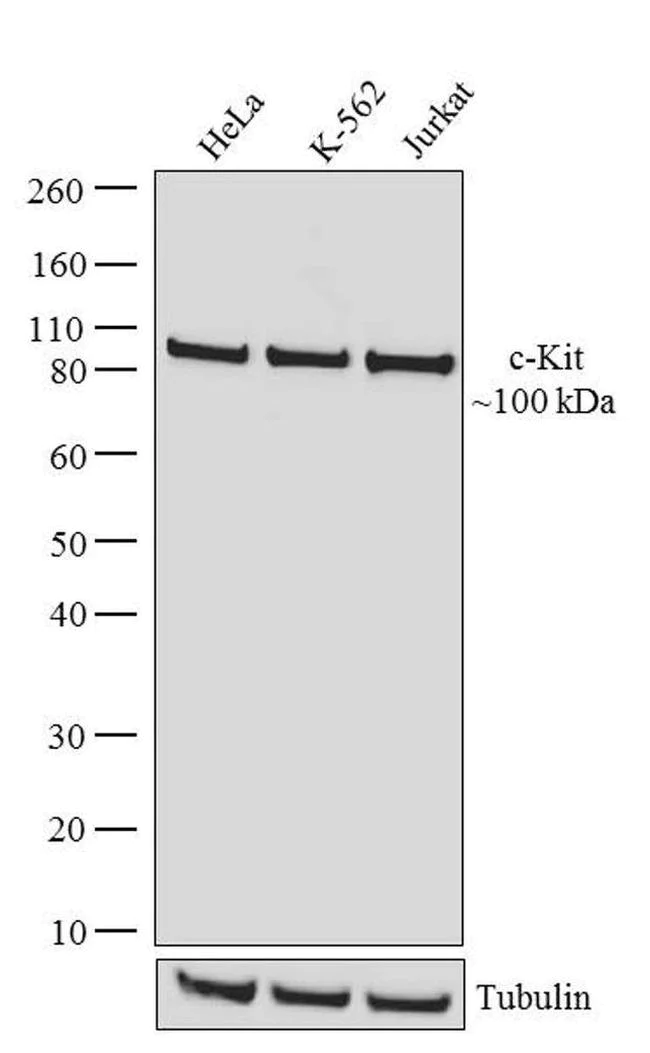 Western blot - Anti-c-Kit antibody [RP23040091] (AB308010)