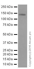 Western blot - Anti-c-Kit antibody [YR145] (AB32363)
