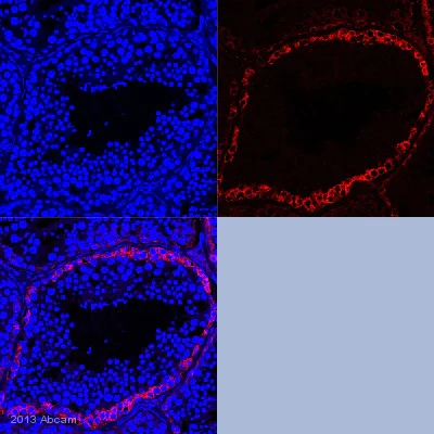 Immunohistochemistry (Formalin/PFA-fixed paraffin-embedded sections) - Anti-c-Kit antibody [YR145] - BSA and Azide free (AB216450)