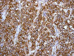 Immunohistochemistry (Formalin/PFA-fixed paraffin-embedded sections) - Anti-c-Kit antibody [YR145] - BSA and Azide free (AB216450)