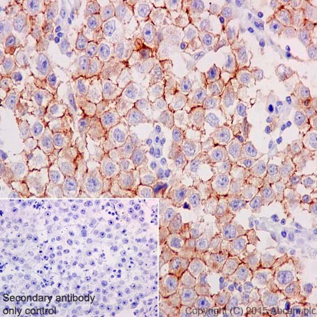 Immunohistochemistry (Formalin/PFA-fixed paraffin-embedded sections) - Anti-c-Kit antibody [YR145] - BSA and Azide free (AB216450), expandable thumbnail