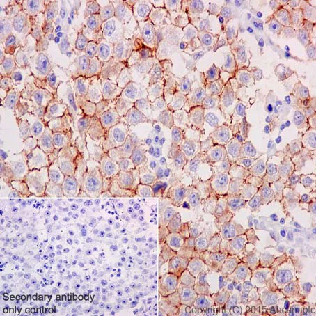 Immunohistochemistry (Formalin/PFA-fixed paraffin-embedded sections) - Anti-c-Kit antibody [YR145] - BSA and Azide free (AB216450)