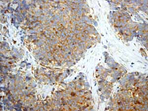 Immunohistochemistry (Formalin/PFA-fixed paraffin-embedded sections) - Anti-c-Kit antibody [YR145] - BSA and Azide free (ab216450), expandable thumbnail
