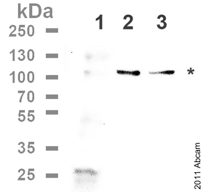 Western blot - Anti-c-Kit (phospho Y703) antibody (AB62154)