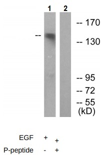 Western blot - Anti-c-Kit (phospho Y703) antibody (AB62154), expandable thumbnail