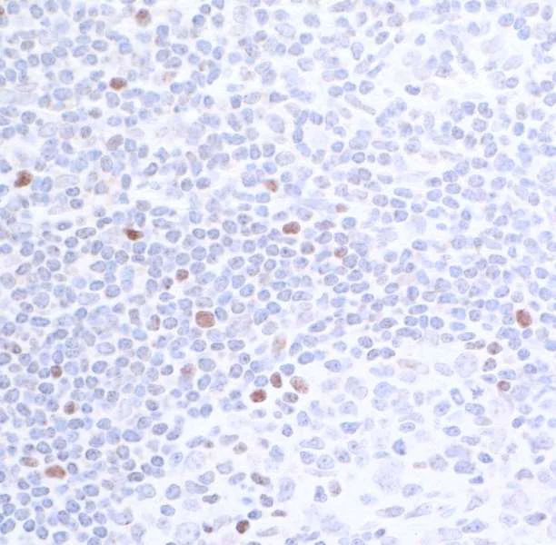 Immunohistochemistry (Formalin/PFA-fixed paraffin-embedded sections) - Anti-c-Maf antibody [BLR045F] - BSA free (AB243901)