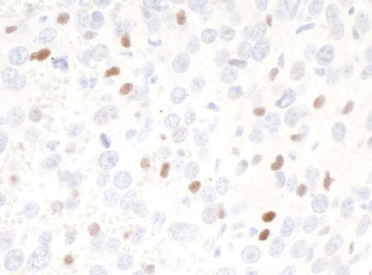 Immunohistochemistry (Formalin/PFA-fixed paraffin-embedded sections) - Anti-c-Maf antibody [BLR045F] - BSA free (AB243901)