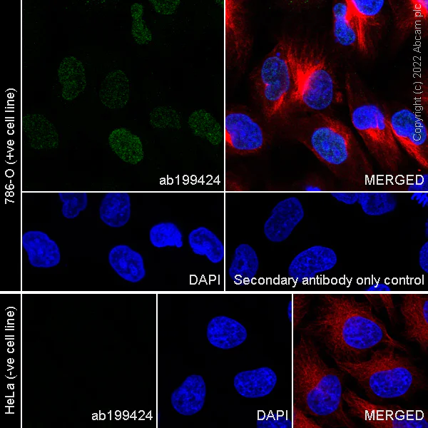 Immunocytochemistry/ Immunofluorescence - Anti-c-Maf antibody [EPR16484] (AB199424)