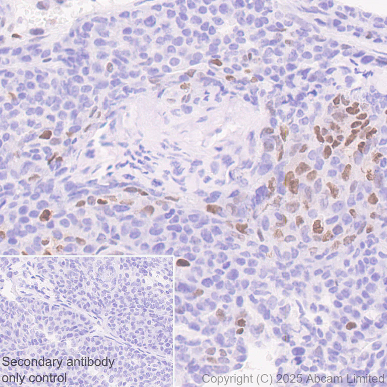 Immunohistochemistry (Formalin/PFA-fixed paraffin-embedded sections) - Anti-c-Maf antibody [EPR29032-12] - BSA and Azide free (AB324537)