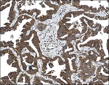 Immunohistochemistry (Formalin/PFA-fixed paraffin-embedded sections) - c-Met Antibody Panel (EP1454Y, EPR19067, SP44, CAL12) (AB252205)