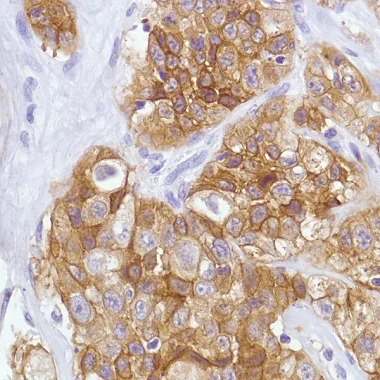 Immunohistochemistry (Formalin/PFA-fixed paraffin-embedded sections) - c-Met Antibody Panel (EP1454Y, EPR19067, SP44, CAL12) (AB252205)