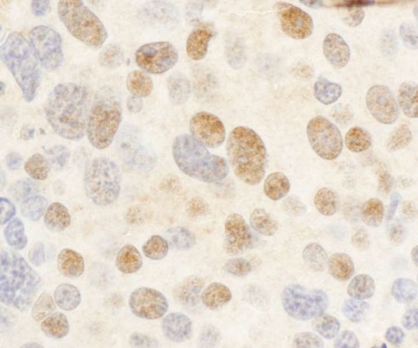 Immunohistochemistry (Formalin/PFA-fixed paraffin-embedded sections) - Anti-c-Myb antibody (AB226470), expandable thumbnail