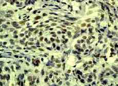 Immunohistochemistry (Formalin/PFA-fixed paraffin-embedded sections) - Anti-c-Myb (phospho S11) antibody [EP769Y] - BSA and Azide free (AB217945)