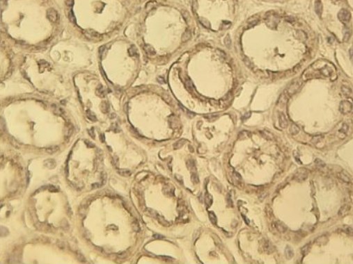 Immunohistochemistry (Formalin/PFA-fixed paraffin-embedded sections) - Anti-c-Myc antibody [8] (AB17355)