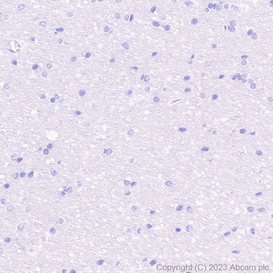 Immunohistochemistry (Formalin/PFA-fixed paraffin-embedded sections) - Anti-c-Myc antibody [Y69] - ChIP Grade (ab32072), expandable thumbnail
