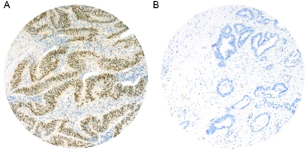 Immunohistochemistry (Formalin/PFA-fixed paraffin-embedded sections) - Anti-c-Myc antibody [Y69] - ChIP Grade (AB32072)