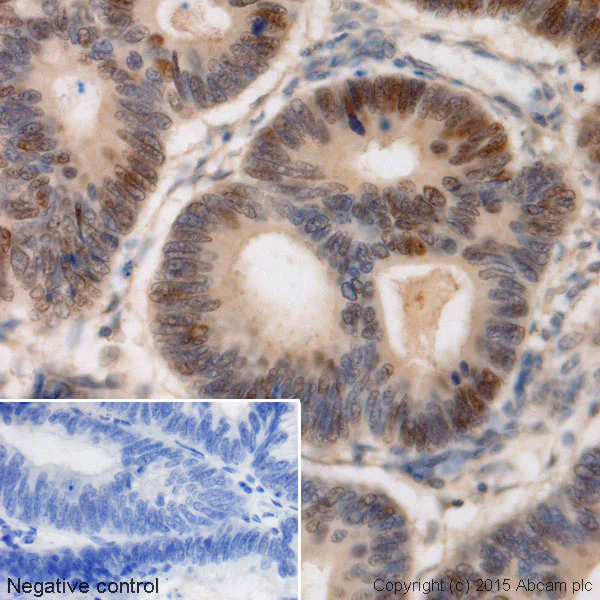 Immunohistochemistry (Formalin/PFA-fixed paraffin-embedded sections) - Anti-c-Myc antibody [Y69] - ChIP Grade (AB32072)