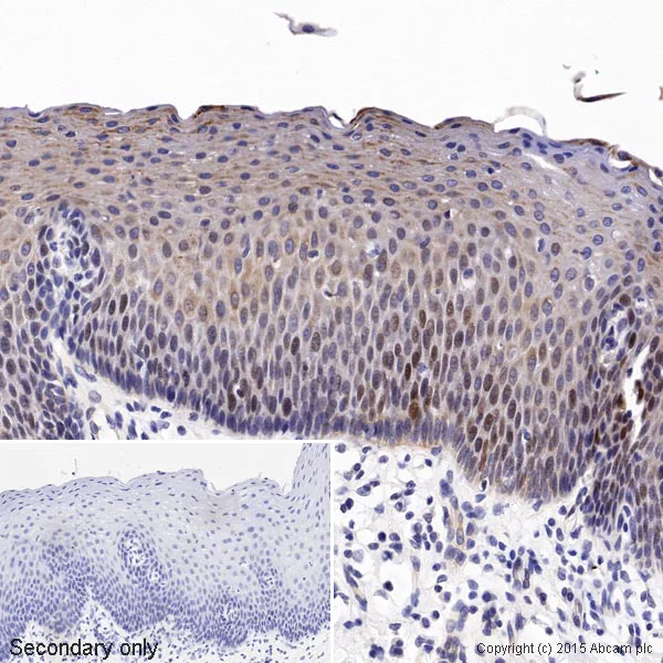 Immunohistochemistry (Formalin/PFA-fixed paraffin-embedded sections) - Anti-c-Myc antibody [Y69] - ChIP Grade (AB32072)