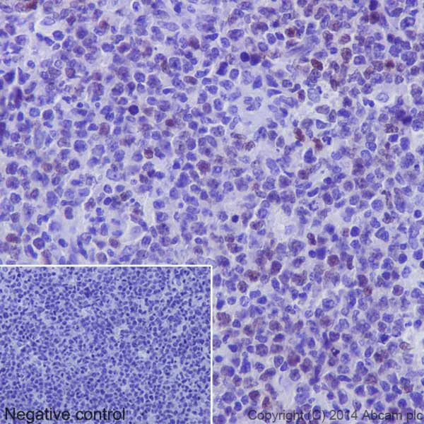 Immunohistochemistry (Formalin/PFA-fixed paraffin-embedded sections) - Anti-c-Myc antibody [Y69] - ChIP Grade (AB32072)