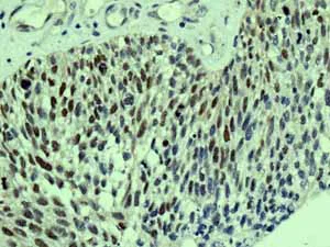 Immunohistochemistry (Formalin/PFA-fixed paraffin-embedded sections) - Anti-c-Myc antibody [Y69] - ChIP Grade - BSA and Azide free (AB168727)