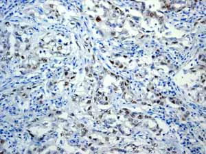 Immunohistochemistry (Formalin/PFA-fixed paraffin-embedded sections) - Anti-c-Myc antibody [Y69] - ChIP Grade - BSA and Azide free (AB168727)