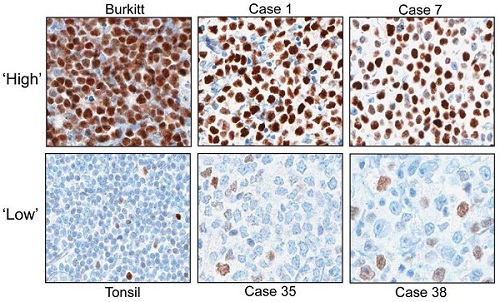 Immunohistochemistry (Formalin/PFA-fixed paraffin-embedded sections) - Anti-c-Myc antibody [Y69] - ChIP Grade - BSA and Azide free (AB168727), expandable thumbnail