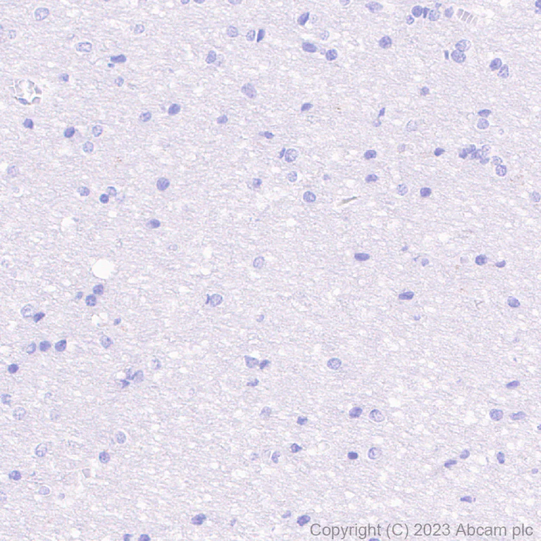 Immunohistochemistry (Formalin/PFA-fixed paraffin-embedded sections) - Anti-c-Myc antibody [Y69] - ChIP Grade - BSA and Azide free (AB168727)