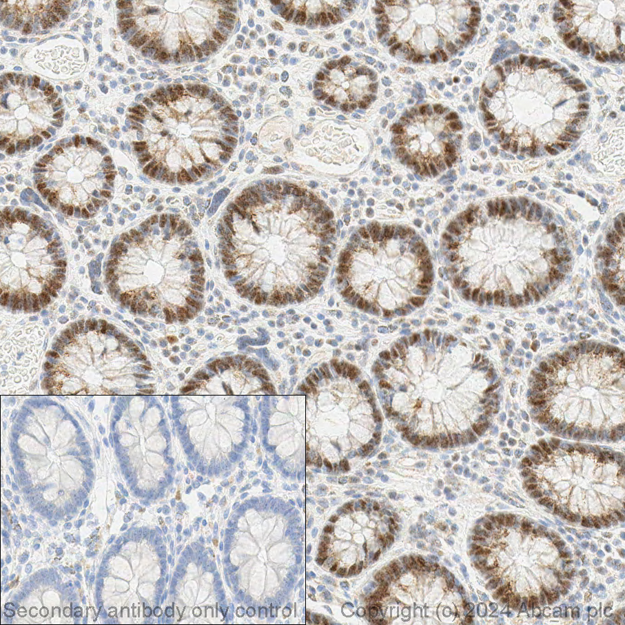 Immunohistochemistry (Formalin/PFA-fixed paraffin-embedded sections) - Anti-c-Myc antibody [Y69] - ChIP Grade - BSA and Azide free (ab168727), expandable thumbnail