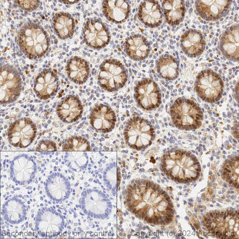 Immunohistochemistry (Formalin/PFA-fixed paraffin-embedded sections) - Anti-c-Myc antibody [Y69] - ChIP Grade - BSA and Azide free (AB168727)