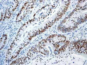 Immunohistochemistry (Formalin/PFA-fixed paraffin-embedded sections) - Anti-c-Myc antibody [Y69] - ChIP Grade - BSA and Azide free (ab168727), expandable thumbnail