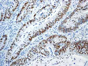 Immunohistochemistry (Formalin/PFA-fixed paraffin-embedded sections) - Anti-c-Myc antibody [Y69] - ChIP Grade - BSA and Azide free (AB168727)