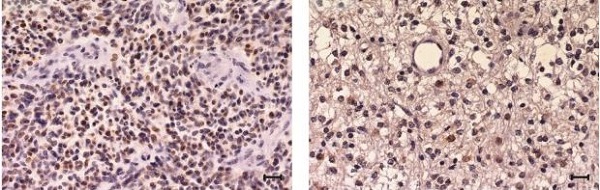 Immunohistochemistry (Formalin/PFA-fixed paraffin-embedded sections) - Anti-c-Myc antibody [Y69] - ChIP Grade - BSA and Azide free (AB168727), expandable thumbnail
