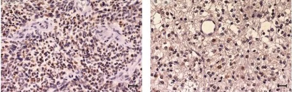 Immunohistochemistry (Formalin/PFA-fixed paraffin-embedded sections) - Anti-c-Myc antibody [Y69] - ChIP Grade - BSA and Azide free (AB168727)
