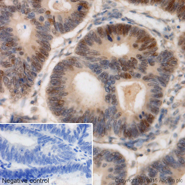 Immunohistochemistry (Formalin/PFA-fixed paraffin-embedded sections) - Anti-c-Myc antibody [Y69] - ChIP Grade - BSA and Azide free (ab168727), expandable thumbnail