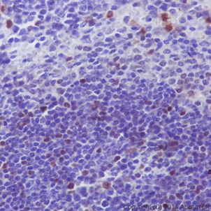 Immunohistochemistry (Formalin/PFA-fixed paraffin-embedded sections) - Anti-c-Myc antibody [Y69] - ChIP Grade - BSA and Azide free (ab168727), expandable thumbnail