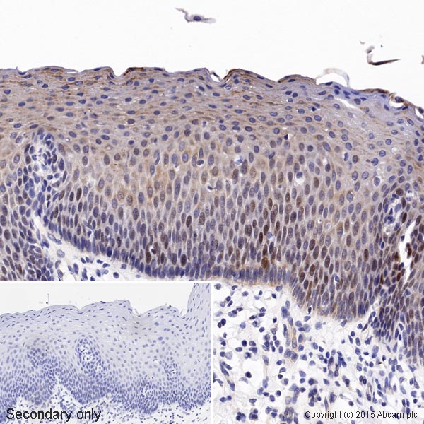 Immunohistochemistry (Formalin/PFA-fixed paraffin-embedded sections) - Anti-c-Myc antibody [Y69] - ChIP Grade - BSA and Azide free (ab168727), expandable thumbnail