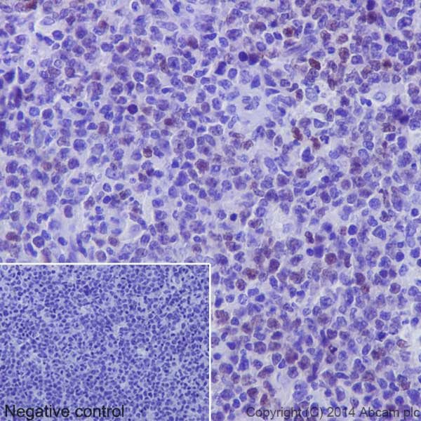 Immunohistochemistry (Formalin/PFA-fixed paraffin-embedded sections) - Anti-c-Myc antibody [Y69] - ChIP Grade - BSA and Azide free (ab168727), expandable thumbnail