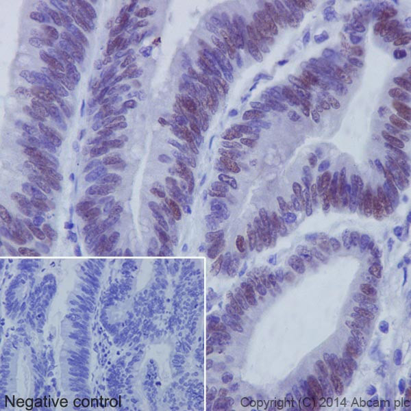 Immunohistochemistry (Formalin/PFA-fixed paraffin-embedded sections) - Anti-c-Myc antibody [Y69] - ChIP Grade - BSA and Azide free (ab168727), expandable thumbnail