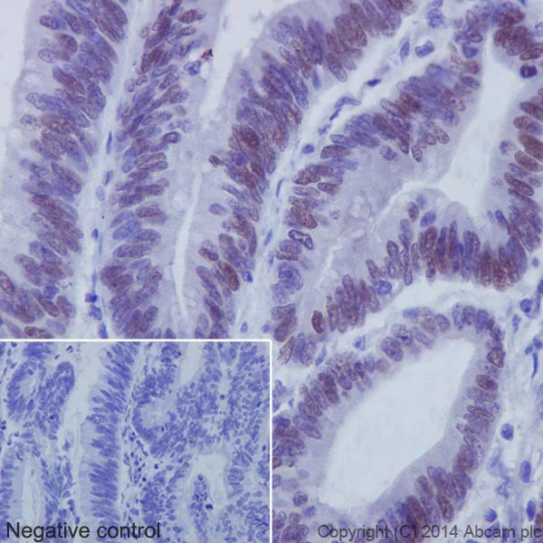 Immunohistochemistry (Formalin/PFA-fixed paraffin-embedded sections) - Anti-c-Myc antibody [Y69] - ChIP Grade - BSA and Azide free (AB168727)