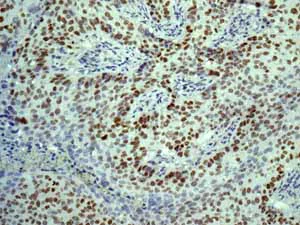 Immunohistochemistry (Formalin/PFA-fixed paraffin-embedded sections) - Anti-c-Myc antibody [Y69] - ChIP Grade - BSA and Azide free (AB168727)
