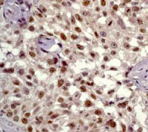 Immunohistochemistry (Formalin/PFA-fixed paraffin-embedded sections) - Anti-c-Myc antibody [Y69] - ChIP Grade - BSA and Azide free (ab168727), expandable thumbnail