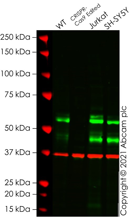 Western blot - Anti-c-Myc antibody [Y69] - ChIP Grade - BSA and Azide free (AB168727), expandable thumbnail