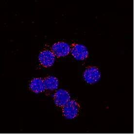 Immunocytochemistry/ Immunofluorescence - Anti-c-Myc (phospho S62) antibody [33A12E10] (AB78318)