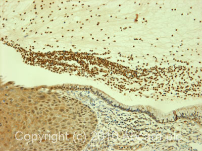 Immunohistochemistry (Formalin/PFA-fixed paraffin-embedded sections) - Anti-c-Myc (phospho S62) antibody [33A12E10] (AB78318)